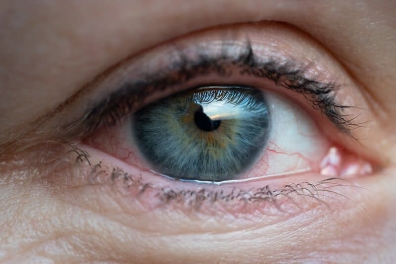 O-glaucoma-atinge-todas-as-faixas-etarias-sendo-mais-incidente-entre-pessoas-acima-de-40-anos