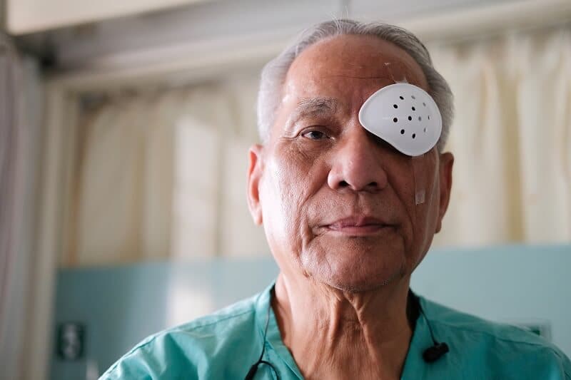 catarata: após a cirurgia o oftalmologista indica o uso de colírios