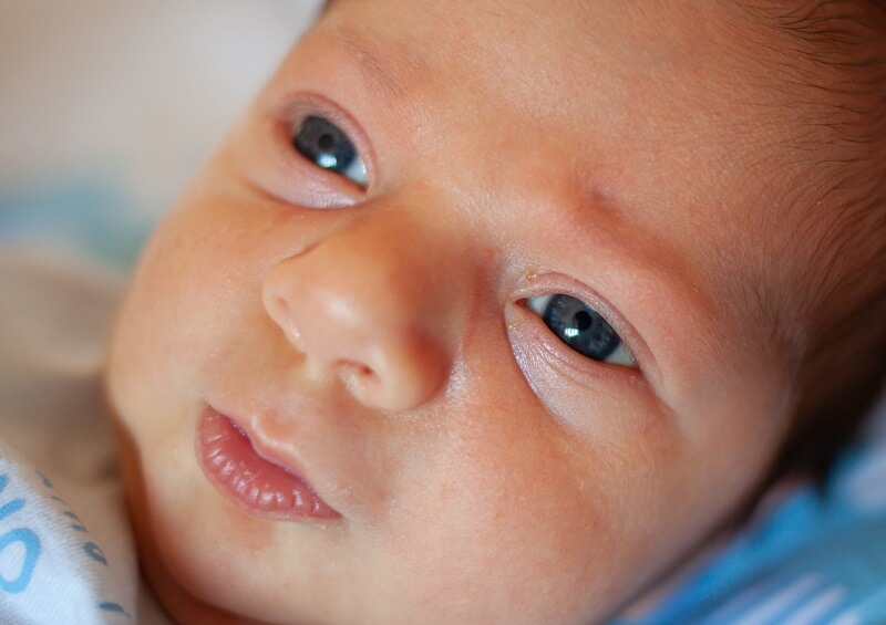 o-teste-do-olhinho-e-o-exame-realizado-no-bebe-para-identificar-sintomas-de-glaucoma-congenito